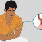 বদহজম